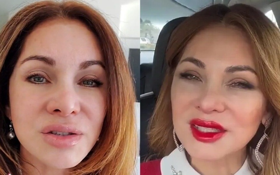 Η νοσοκόμα της Καλιφόρνιας μοιράζεται πώς φαίνεται το πρόσωπό της μετά τη διακοπή των ενέσεων Botox>