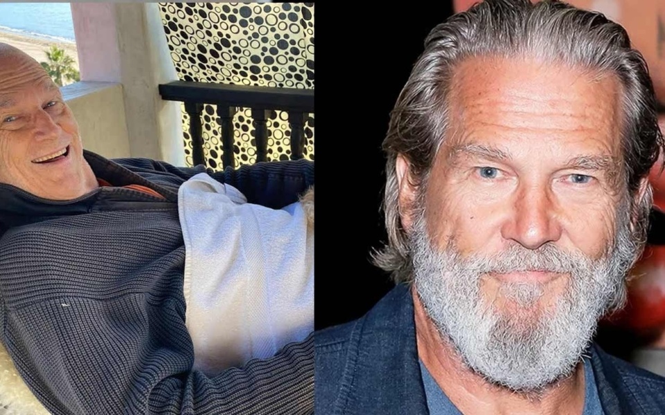 Ο Jeff Bridges θριαμβεύει πάνω από τον καρκίνο: Συρρίκνωση ενός όγκου 30 εκατοστών – Εμπνευσμένη αποκατάσταση και συνέχιση των γυρισμάτων>