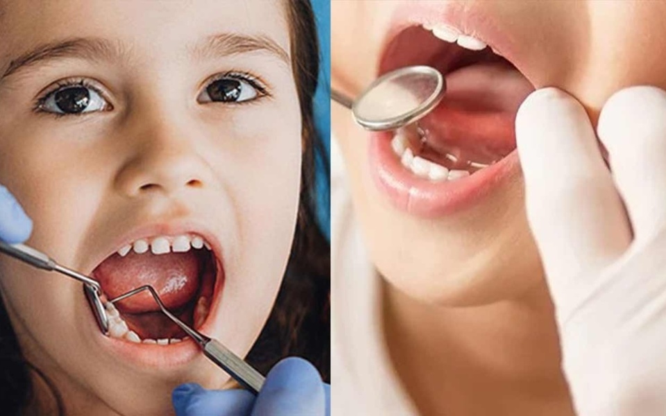 Dentist Pass: Κάντε αίτηση τώρα για δωρεάν οδοντιατρικές επισκέψεις>