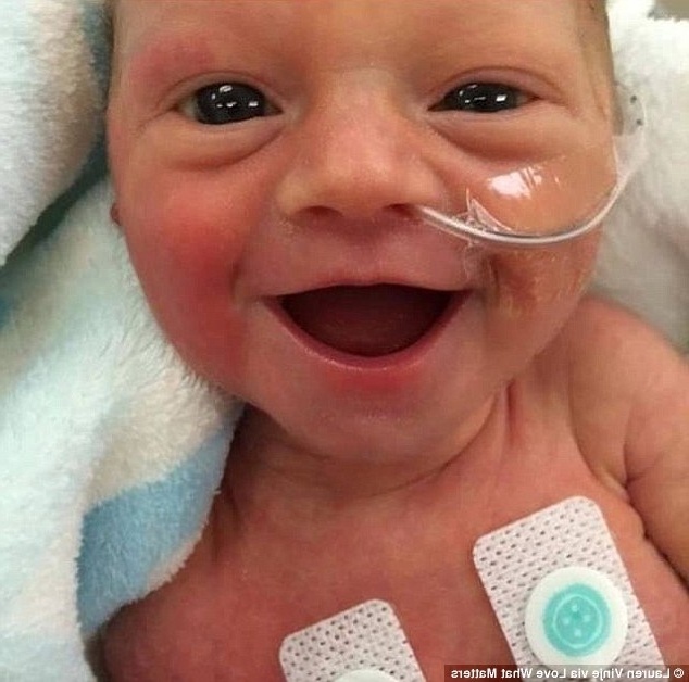 Θαύμα της ζωής: Η λαμπερή χαρά του πρόωρου μωρού εμπνέει εκατομμύρια ανθρώπους στο διαδίκτυο