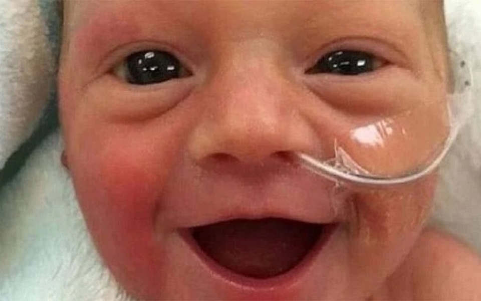 Θαύμα της ζωής: Η λαμπερή χαρά του πρόωρου μωρού εμπνέει εκατομμύρια ανθρώπους στο διαδίκτυο>
