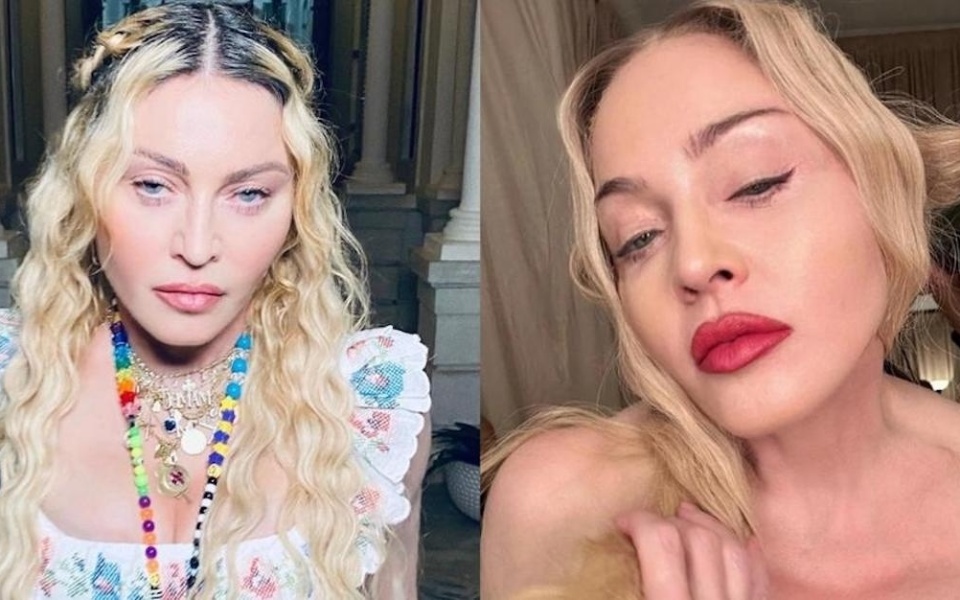 Η σωτήρια ένεση της Madonna: Ξεπερνώντας την υπερβολική δόση φαρμάκων και το σηπτικό σοκ>