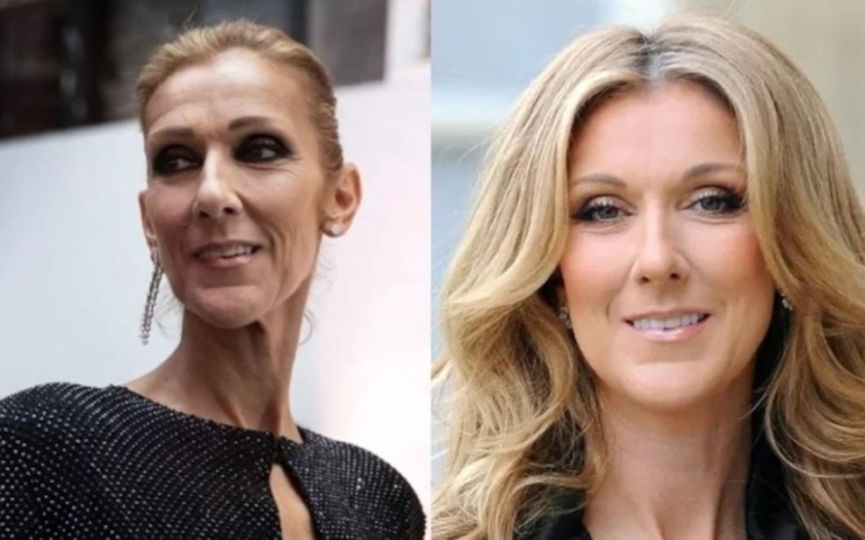 Μάχη για την υγεία της Celine Dion: Ακύρωση παγκόσμιας περιοδείας και ελπιδοφόρα λόγια από την αδελφή της>